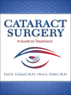 cover image of Cataract Surgery
